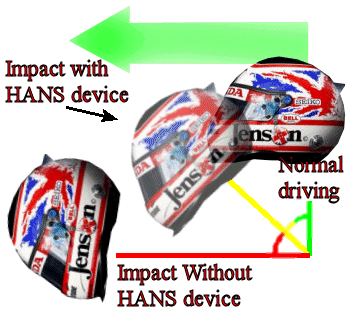 Impact with and without HANS